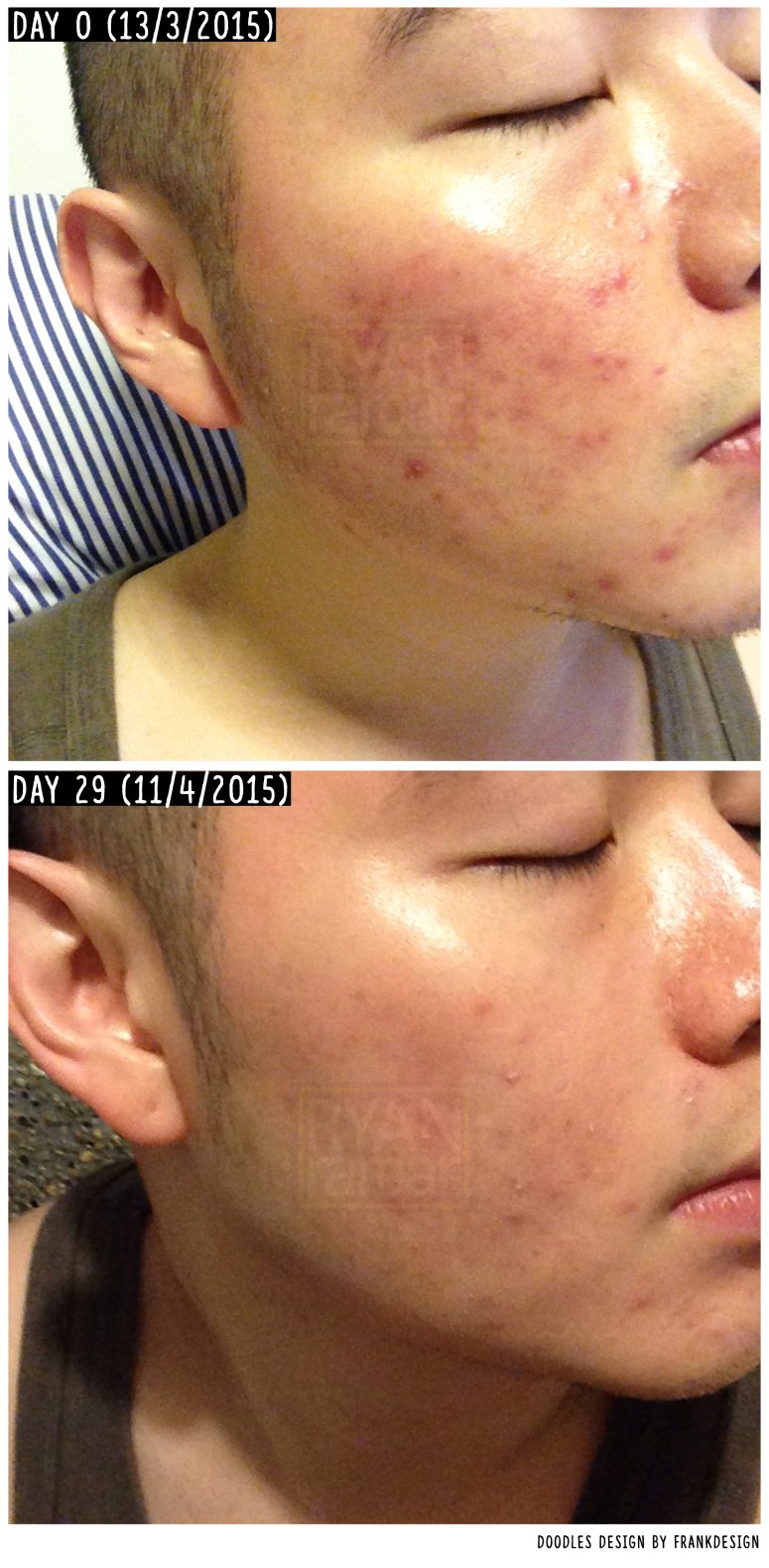 (My apologies if you were disgusted or put off by the images here)