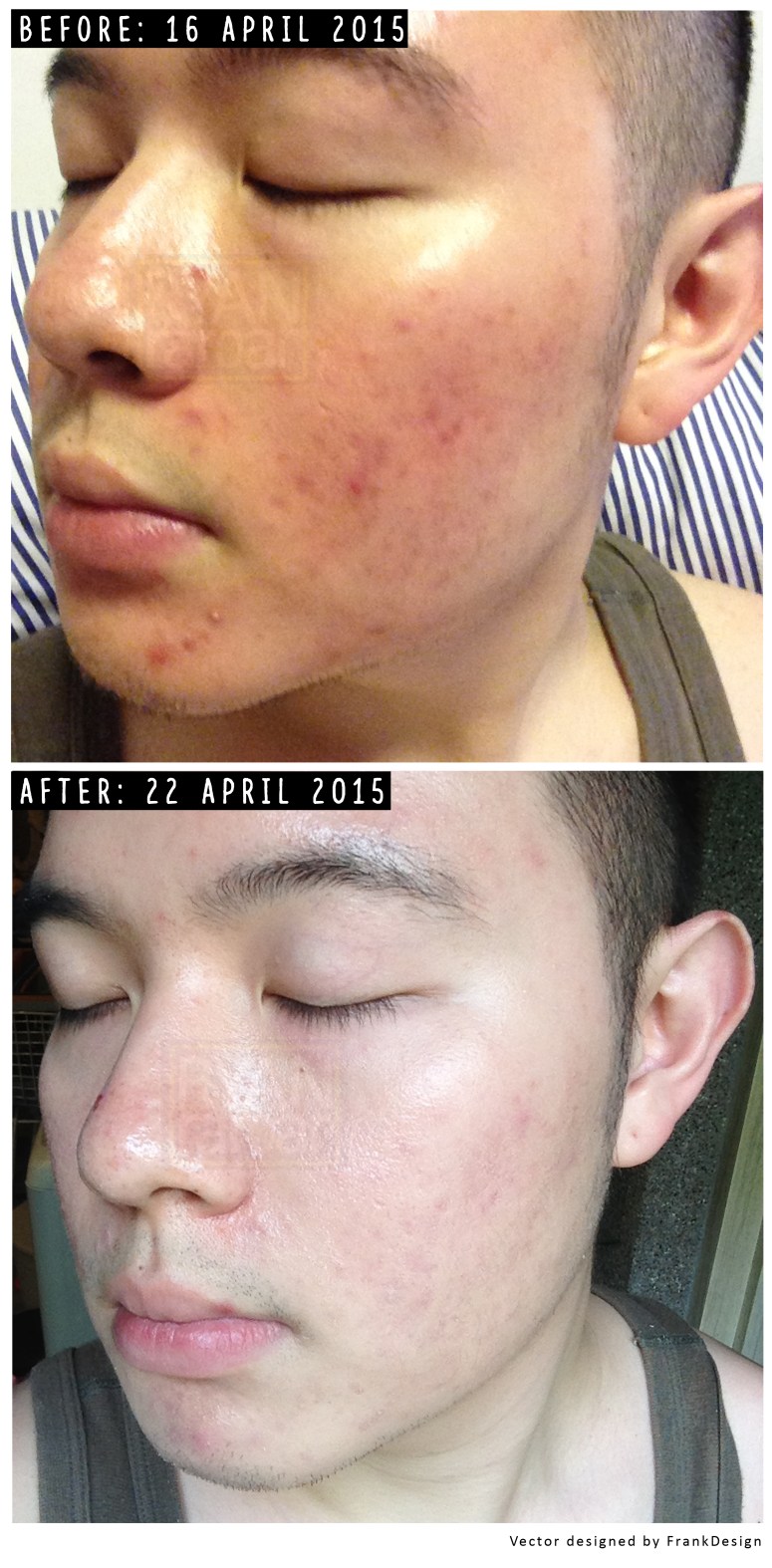 (My humble result after using the regime - no other skin care products outside the brand - for 6 days)